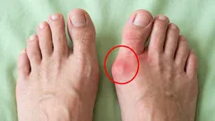 Diciamo addio alle ossa dei piedi: 6 esercizi per rilassare anche i piedi